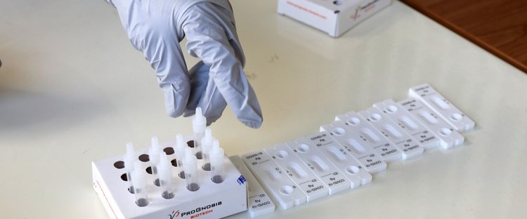 Αύξηση στα κρούσματα κορωνοϊού-«Έχουν χαλαρώσει τα μέτρα, όμως δεν είναι ανησυχητικό»